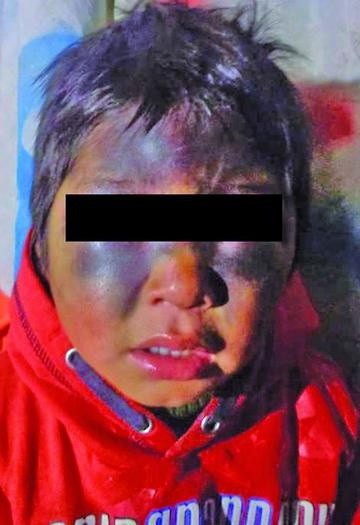 Policía dice que el niño se cayó y no fue golpeado