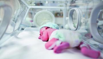 Gobierno: el 35 por ciento de los niños que mueren al nacer es prematuro