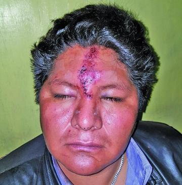 Denuncian que un dirigente del Conamaq fue agredido