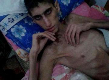 Reportan 35 muertes por inanición en región siria