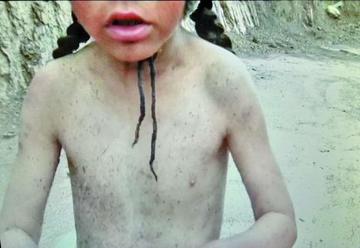 Un concejal salva la vida de una niña