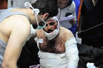 Uno de los heridos recibe atención médica en un hospital de Damasco, la capital siria.