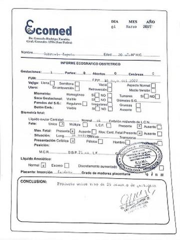 Uno de los resultados de las econgrafías del aparente hijo de Gabriela Zapata y Evo Morales. Foto: ANF