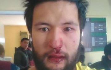 Golpeado por choferes tiene ocho días de impedimento