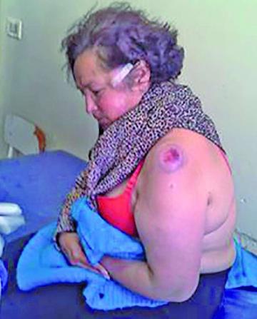 La dirigente municipal Mary Céspedes.