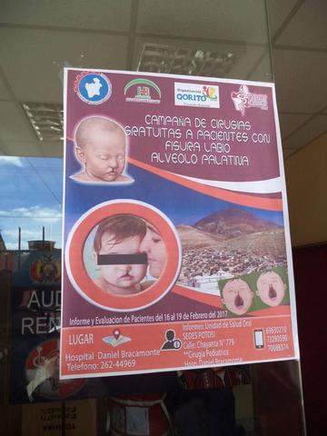 Relanzan campaña gratuita de cirugías de labio leporino