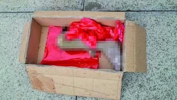 Hallan una pieza humana en medio de la basura