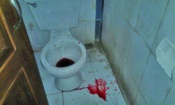 Una mujer abortó en un baño público
