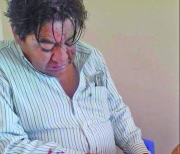 Viceministro se accidenta  y afirman que estaba ebrio