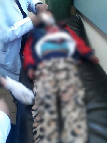 La niña recibe atención en el Bracamonte.