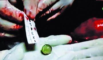 La canica habría sido presumiblemente disparada con un petardo.