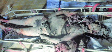Otro minero muere y no identifican el cadáver