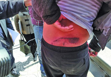 Acusan a efectivos por agresión física y la Policía desmiente