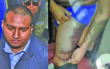 Las fotografías revelan varias heridas y los golpes recibidos por el acusado del desfalco al Banco Unión.