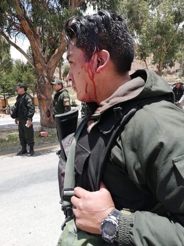 Uno de los cinco policías heridos.
