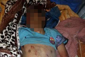 Joven minero cae al abismo y pierde la vida instantáneamente en una mina