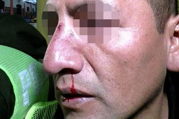 Músico rompe nariz de policía con mazo