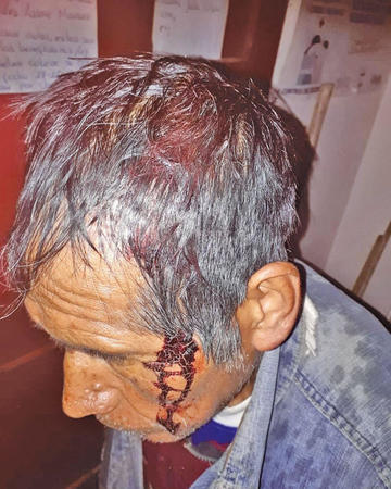 Uno de los afectados.