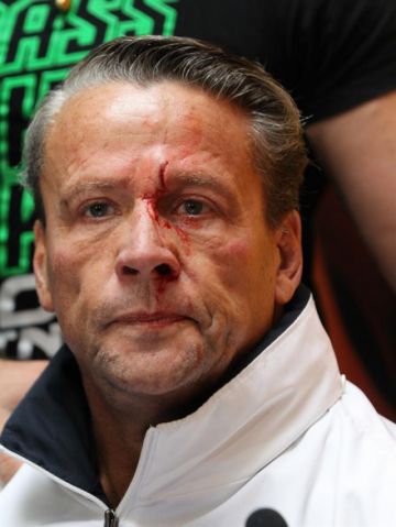 El actor terminó lesionado