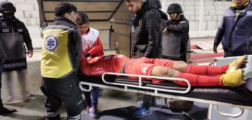 Gonzalo Moruco abandona el campo deportivo en camilla tras un golpe en la espalda.