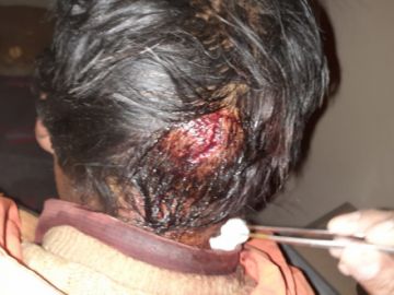 Hay heridos hospitalizados.