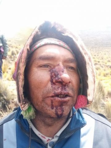 Fotografías de algunos heridos.