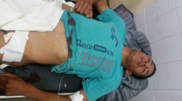 Los heridos en Challapata.