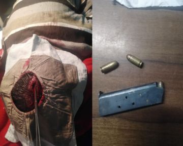 La cabeza del hombre fue agujereado y la cacerina del arma fue incautado.