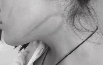 Denuncian que una niña de 14 fue flagelada por un menor de 16 años