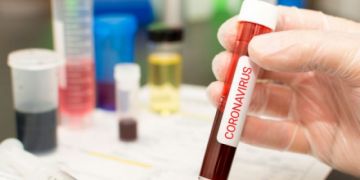 Niño de 1 año está entre los afectados por coronavirus