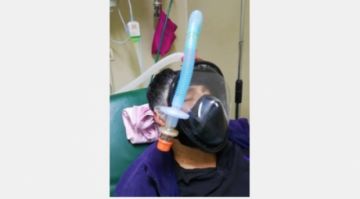 La Paz: médico fabrica un sistema de respiración para salvar la vida de sus pacientes