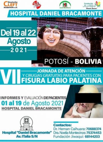 Se desarrolla la séptima jornada de cirugías gratuitas de fisura labio palatina