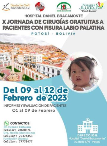 Realizarán cirugías labio palatinas gratuitamente