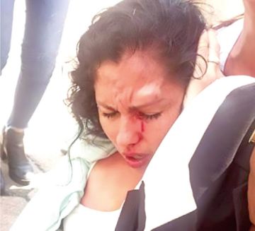 Aprehenden a 5 personas por agredir a asambleísta