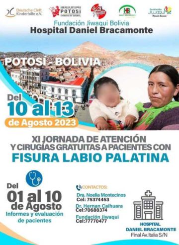 Habrá cirugías de fisura labio palatina del 10 al 13 de agosto