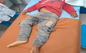 Un niño de un año pierde la vida al ser embestido por un chofer de minibús