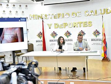 Salud reporta nuevo caso de sarampión y activa alerta nacional
