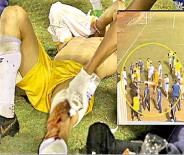 Policia dispara a jugador en Brasil