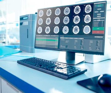 Los cerebros envejecieron  más rápido en el covid-19