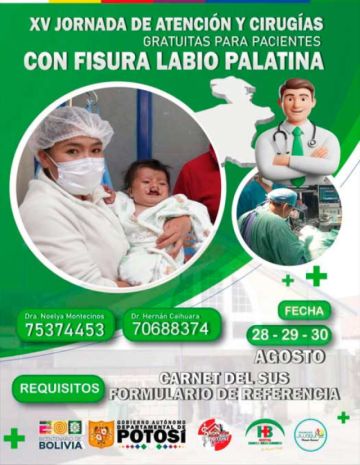 Alistan nueva campaña de cirugía de fisura labio palatina