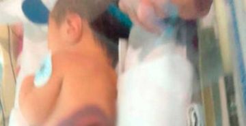 Investigan posible infanticidio tras hallazgo de neonato sin vida en Llallagua