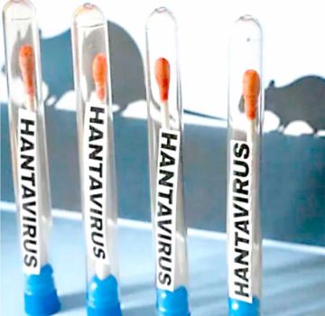 Hantavirus: Tarija registra cuatro casos y activa alerta