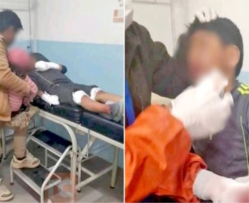 Niño pierde cuatro dedos  por petardos de bloqueos