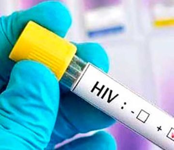 Los casos de VIH disminuyen en el Departamento de Potosí 