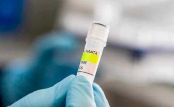 Confirman caso de hantavirus en Potosí, proveniente de Tarija