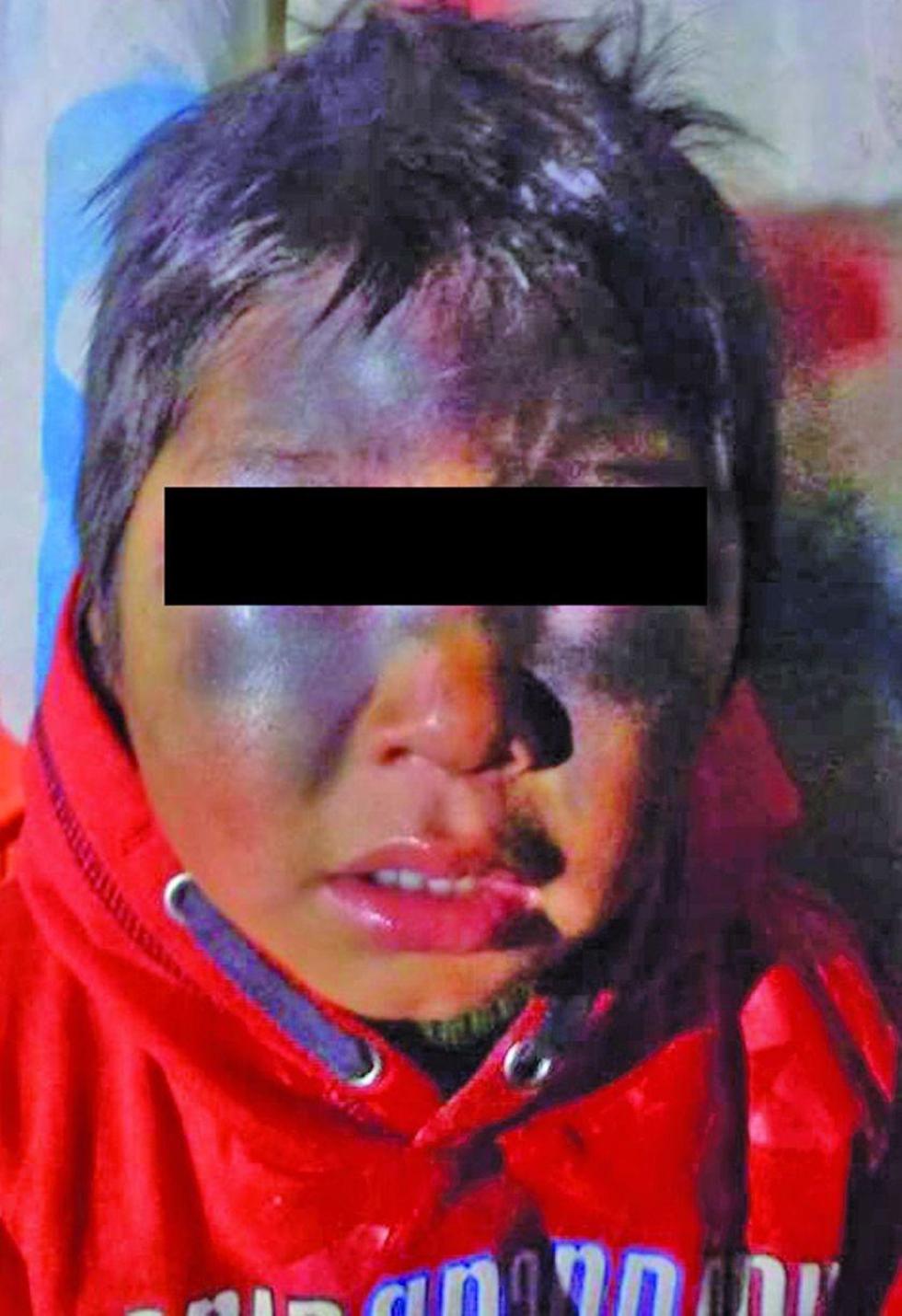 Policía dice que el niño se cayó y no fue golpeado