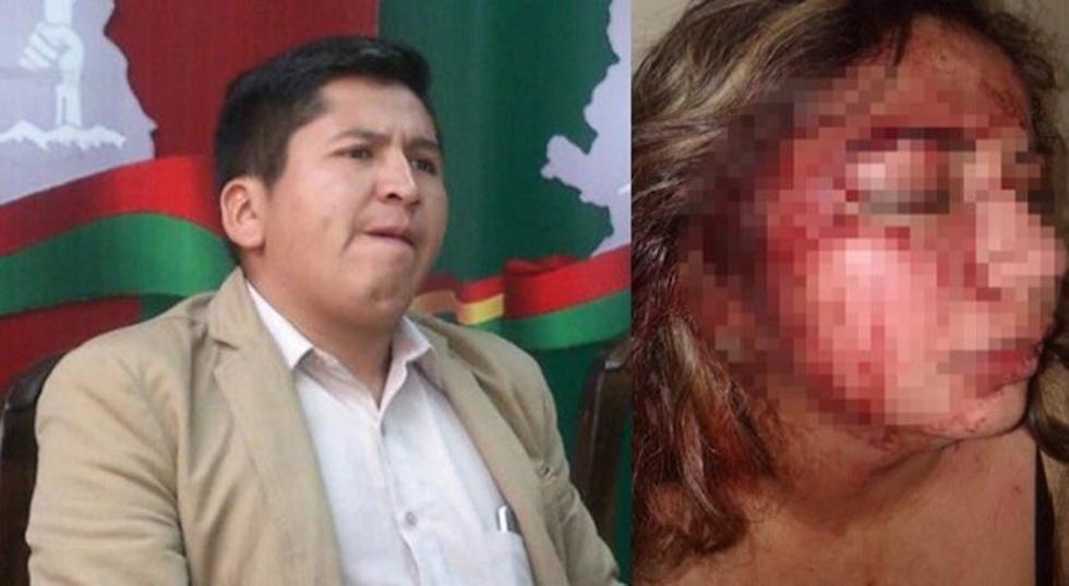 La víctima de Sandoval rechazó atención médica y desapareció