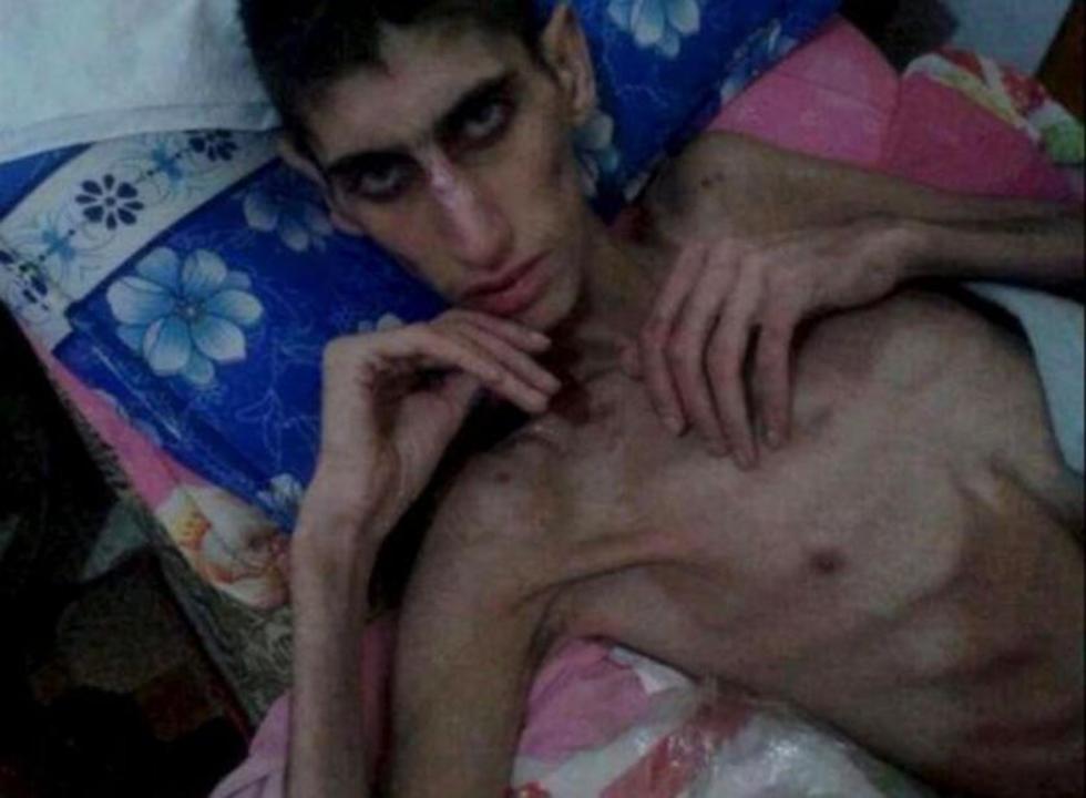 Reportan 35 muertes por inanición en región siria