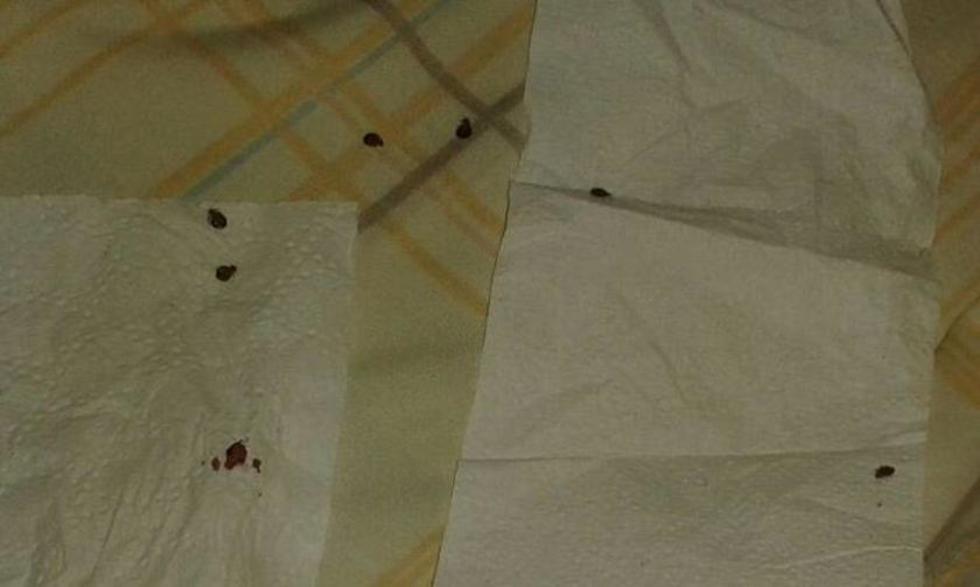 Garrapatas atacan a dos mujeres en alojamiento potosino