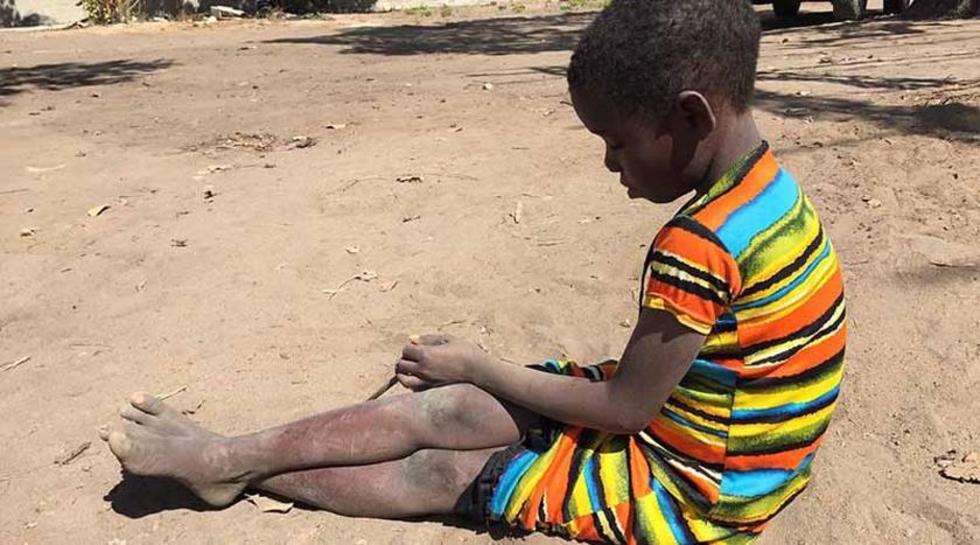 ONU: 75.000 niños podrían morir de hambre en Nigeria